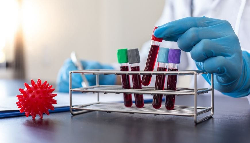 North America In Vitro Diagnostics Market: Insights and Market Value in 2023